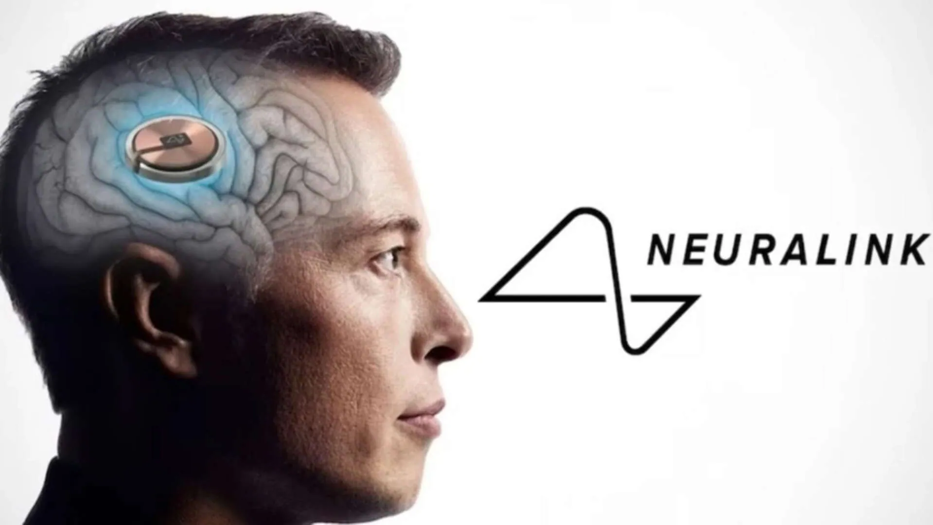 Neuralink Brain-Computer